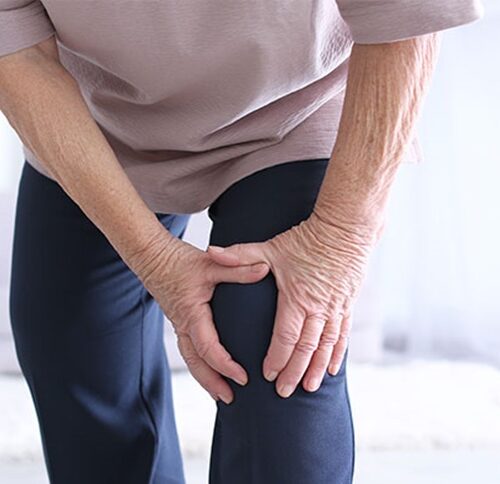 viscosupplementation for osteoarthritis of the knee viscosupplementation for osteoarthritis of the knee