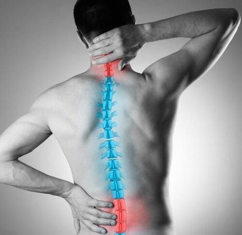 what is a facet joint injection what is a facet joint injection