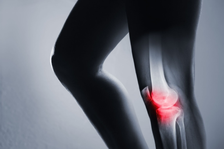 Why osteoarthritis causes severe pain