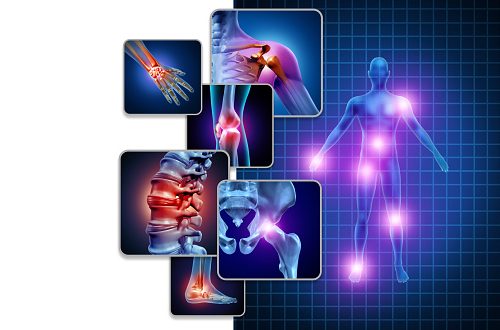 fibromyalgia pictur Fibromyalgia Treatments in New York
