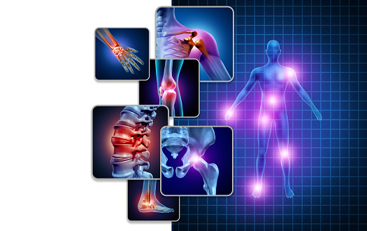 fibromyalgia pictur Fibromyalgia Treatments in New York