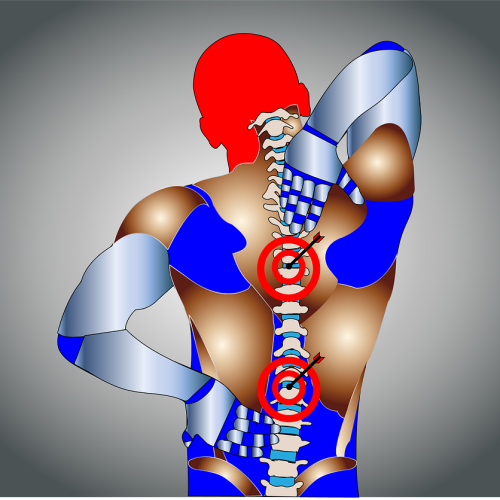 ESI The Benefits of Epidural Steroid Injections for Pain Management