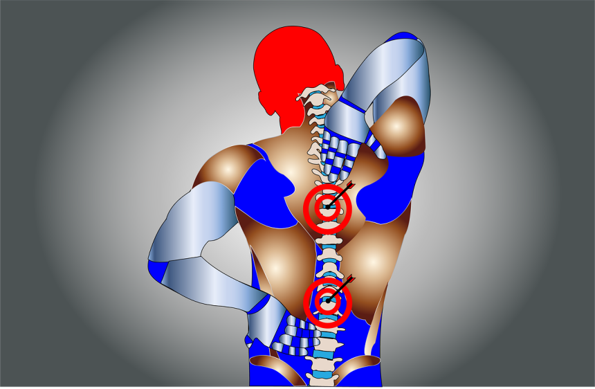 The Benefits of Epidural Steroid Injections for Pain Management